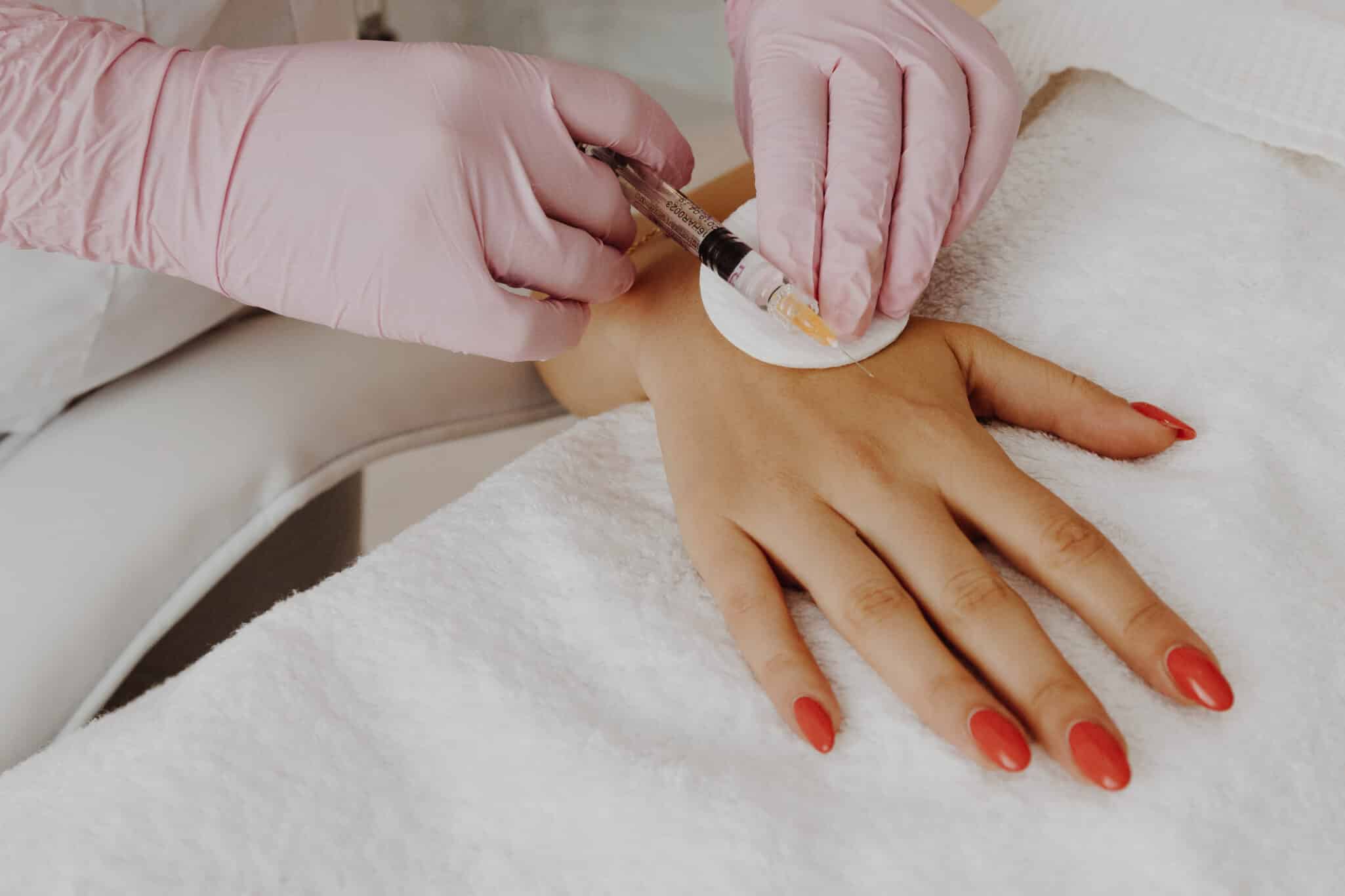 Fillers, rejuvenation of hands