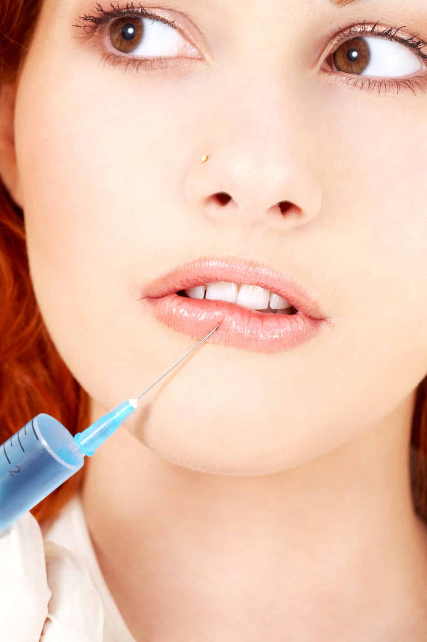 lips enlargement procedure for young caucasian woman