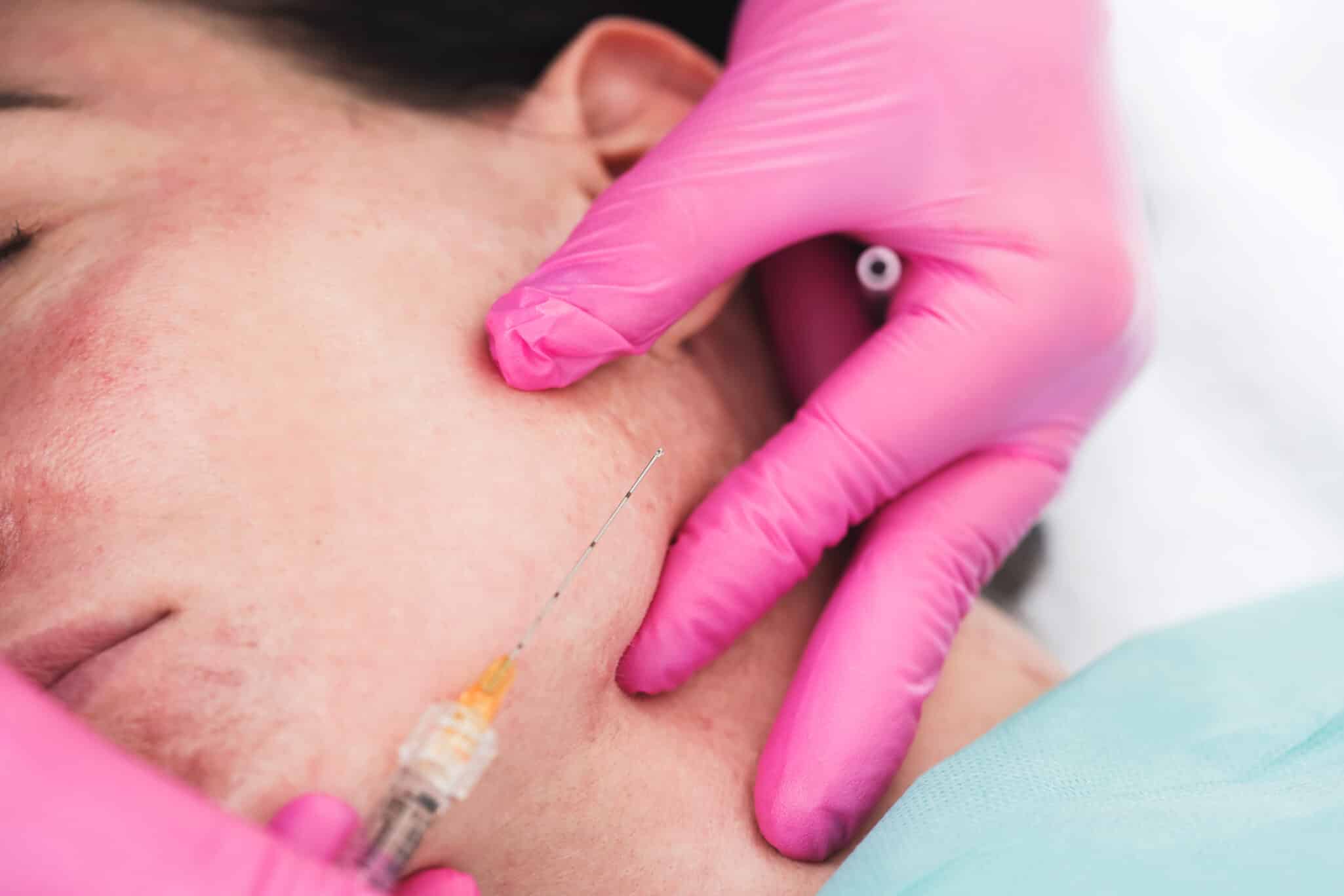 patient receiving injectable treatment in cheek from med spa professional in pink gloves