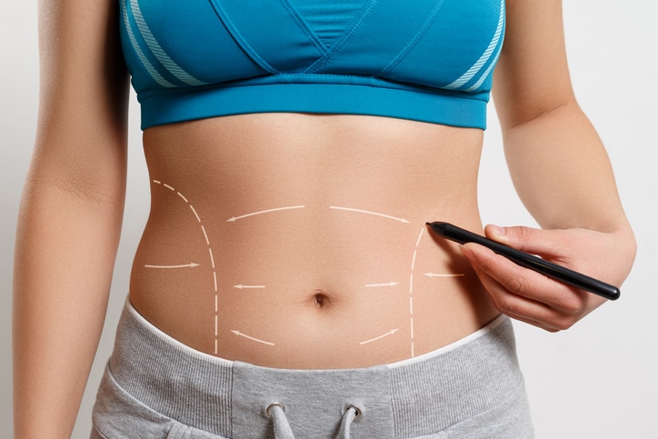 Body Contouring in Salem, OR